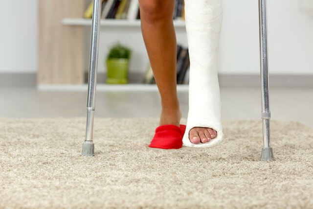 Close up of a woman's legs, one of which is in a cast, with crutches on both sides bracing her as she stands